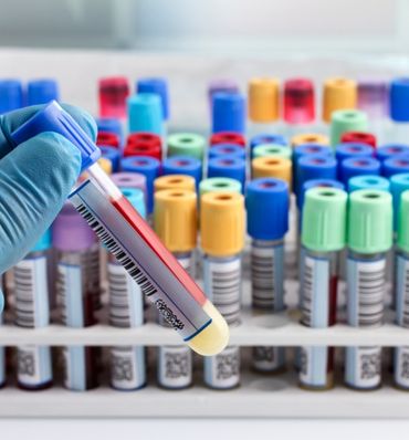 Laboratoire d'Analyses